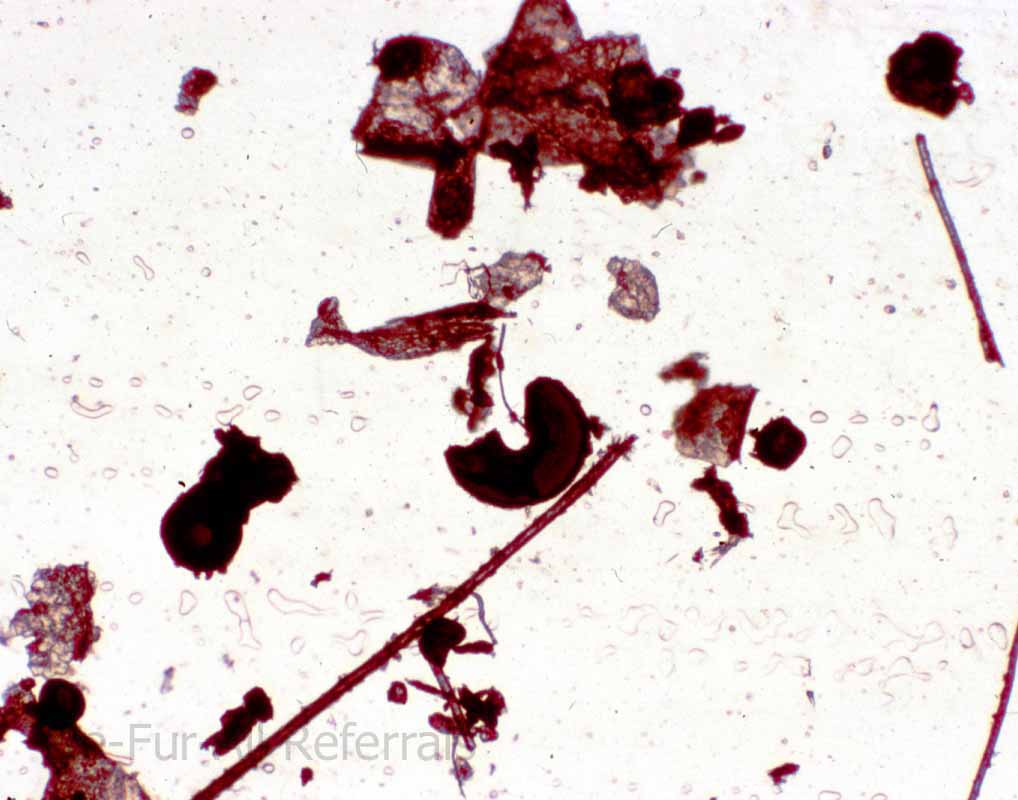 Flea faeces